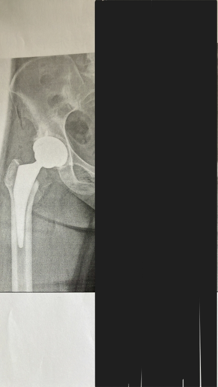 入院をして学んだこと
